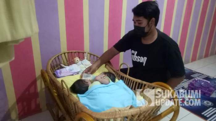 Pisang dempet sebabkan anak lahir dengan kondisi kembar siam